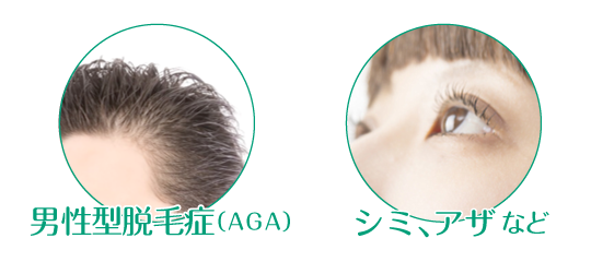 自費診療のご案内のイメージ